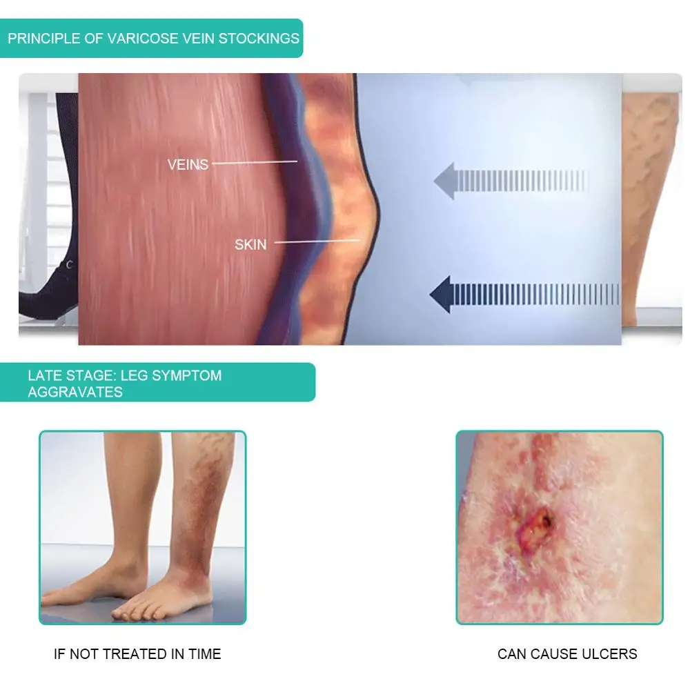 1 çift tıbbi varis çorabı 30-4 - Compression Sleeve Calf incelemesi ve fiyatı